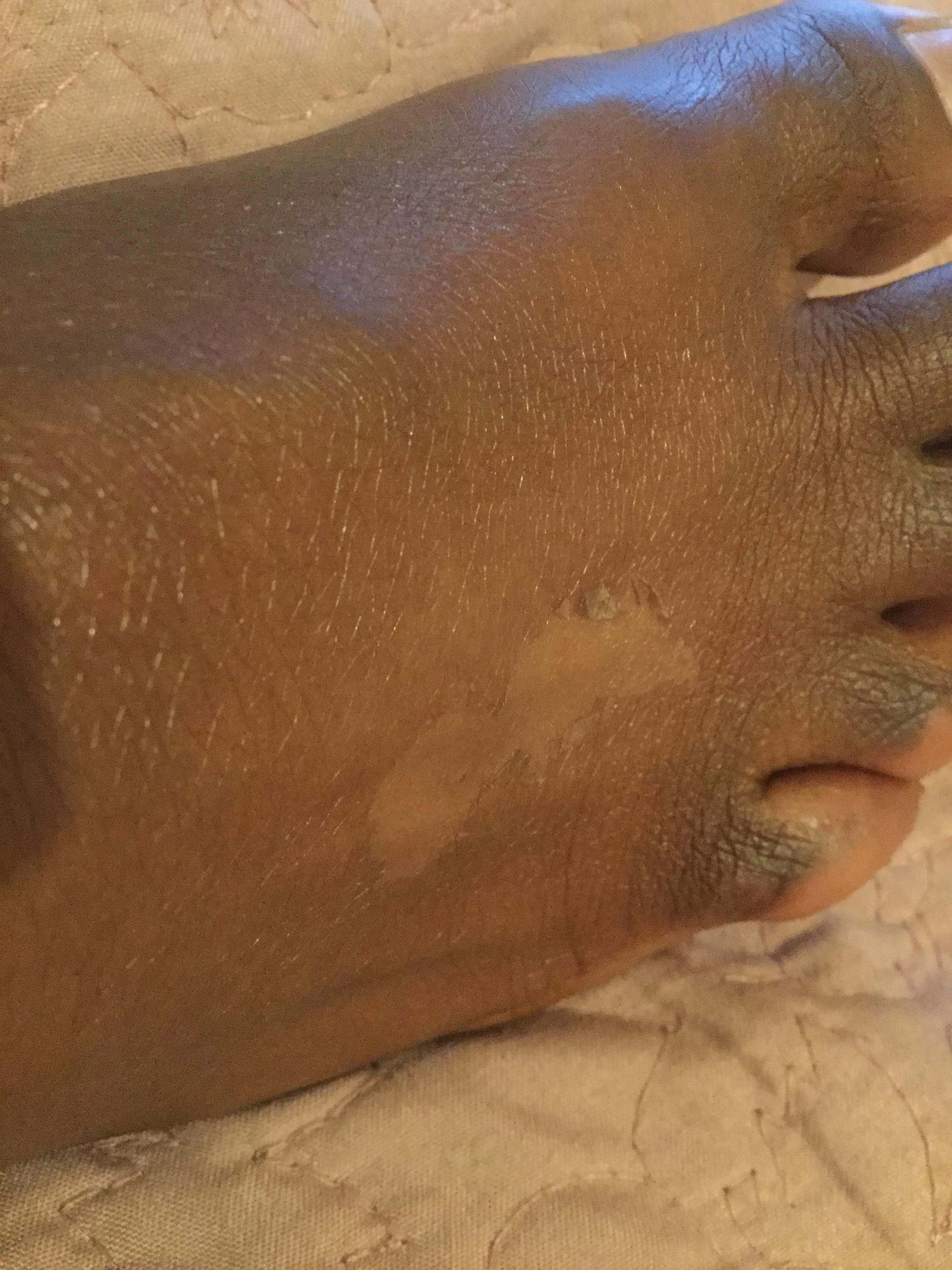yellow peeling oil results