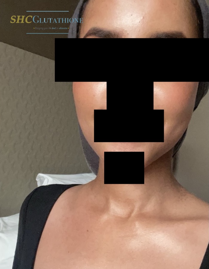 SHCGlutathione Results