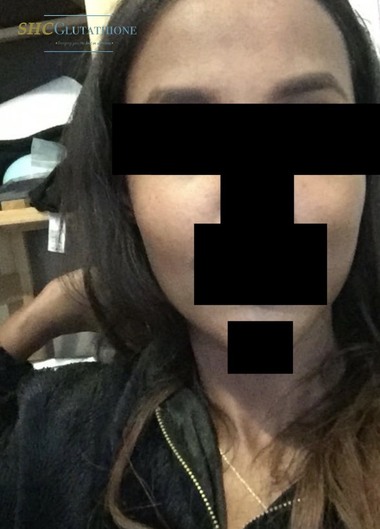 SHCGlutathione Results