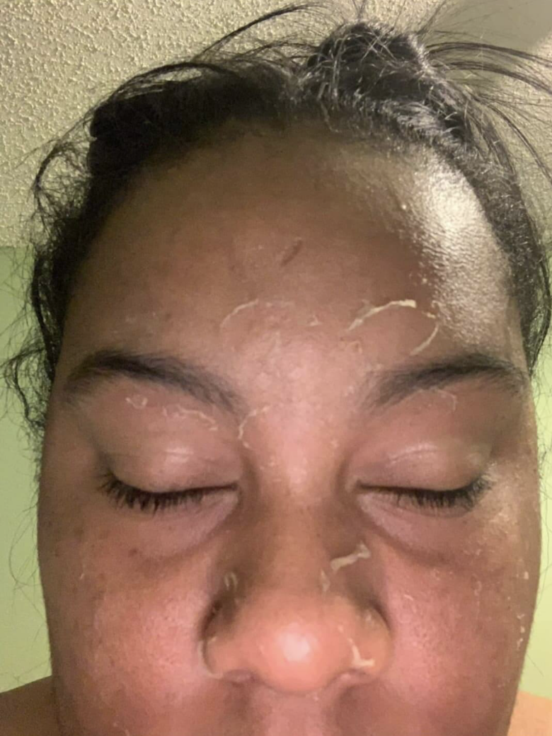 SHCGlutathione Results