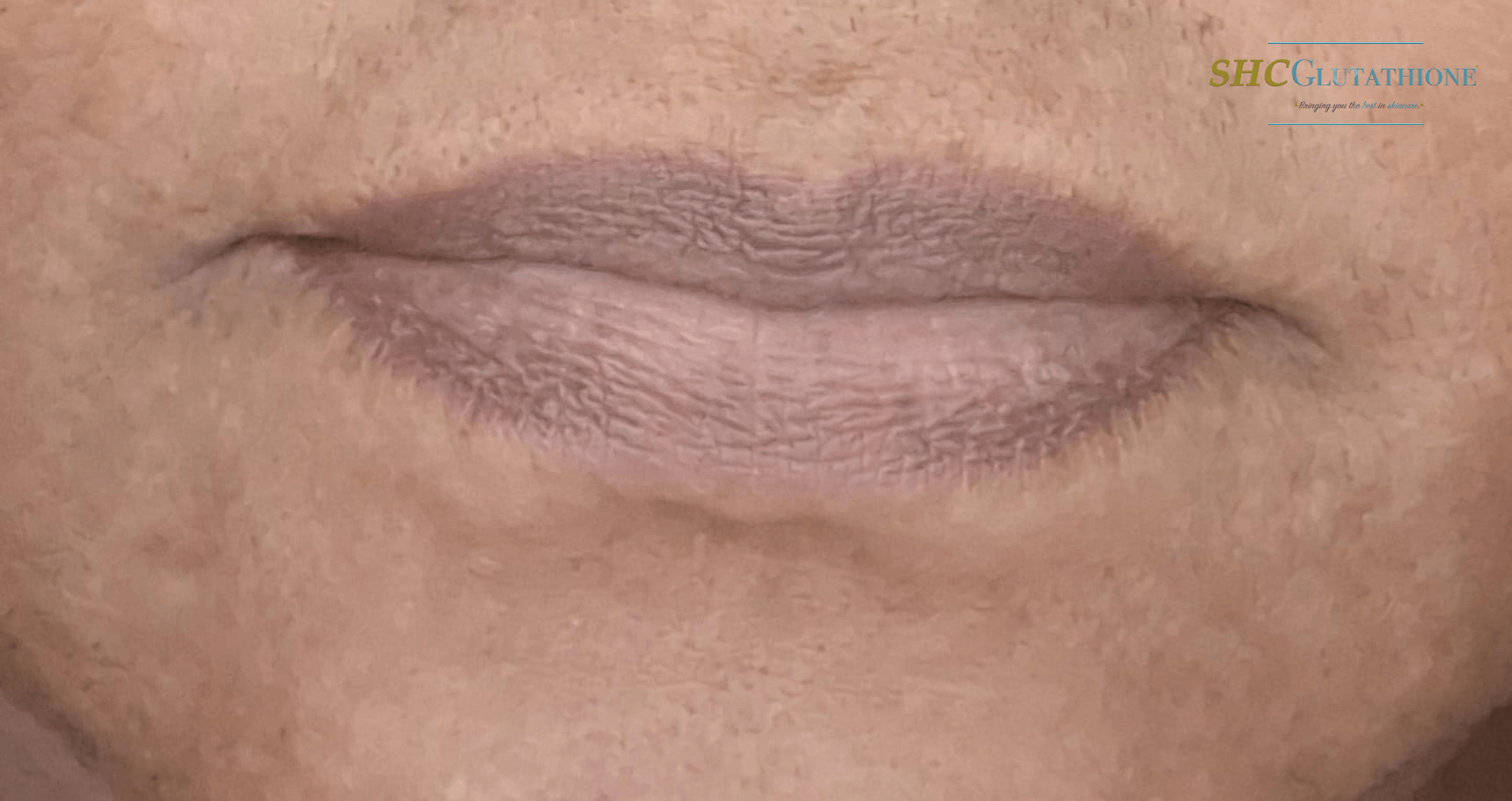 lip lightening cream dark lips before and after result