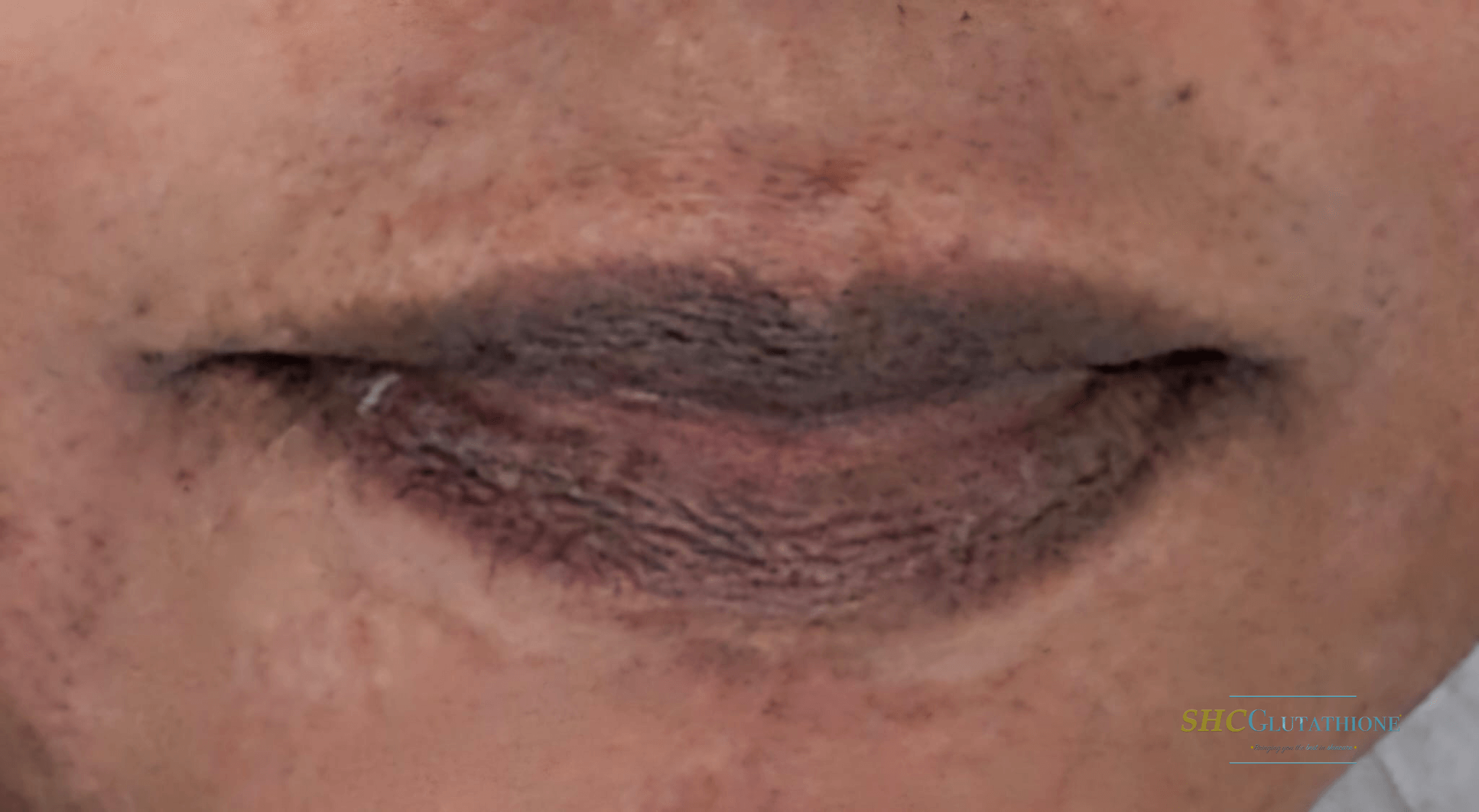 lip lightening cream dark lips before and after result